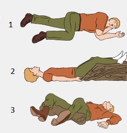 Оптимальными положениями тела пострадавшего и вероятными травмами. Положение пострадавшего при травме брюшной полости. Оптимальное положение тела пострадавшего при травме брюшной полости. Поза пострадавшего при травме брюшной полости. Оптимальное положение при травме брюшной полости.